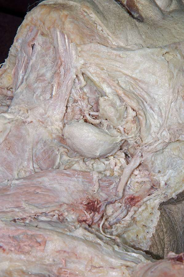 Submandibular Gland