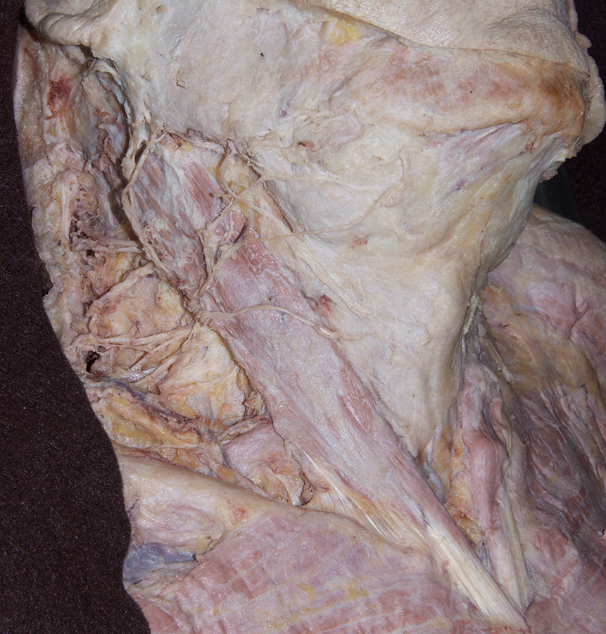 Cervical Plexus Cutaneous Nerves