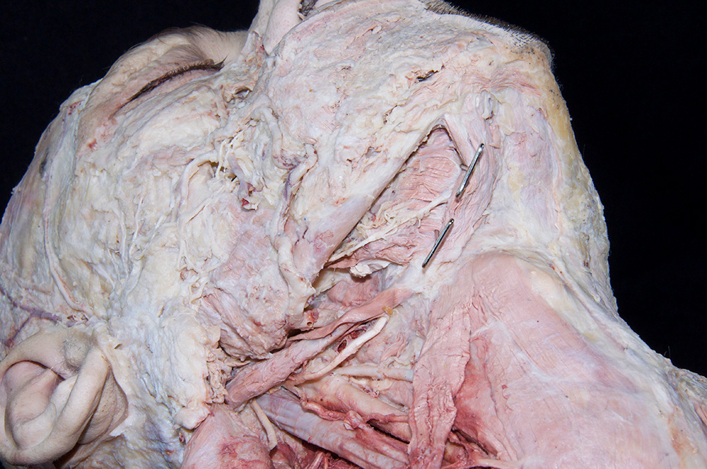 Mylohyoid Muscle