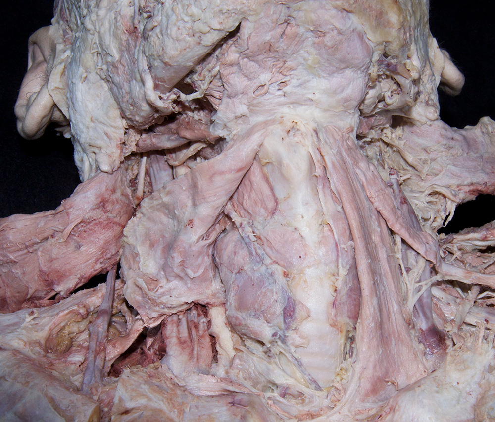 Thyroid Gland
