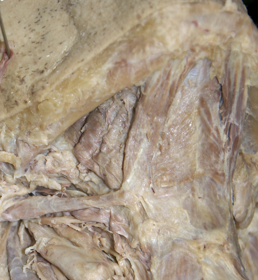 Right Suprahyoid Muscles