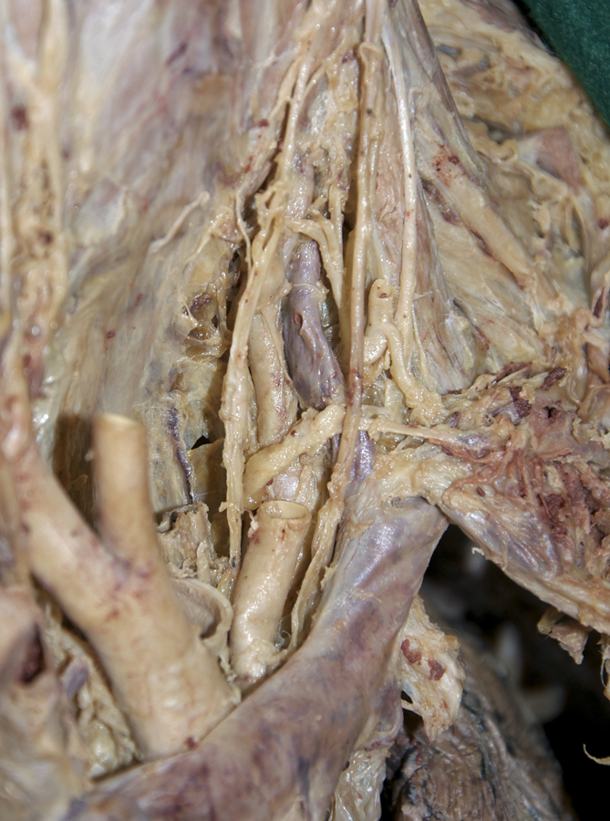 Thoracic Duct