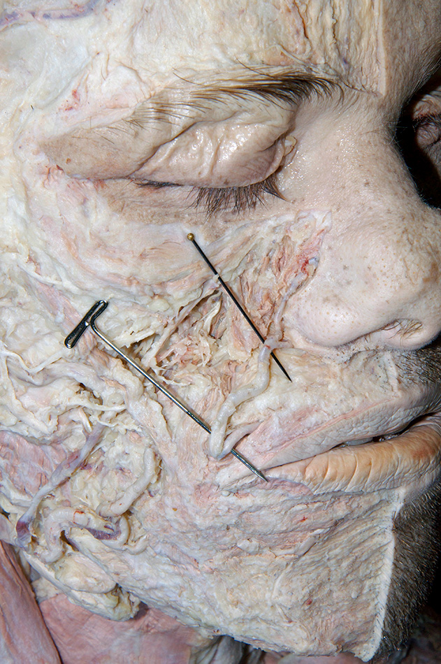 Angular Artery