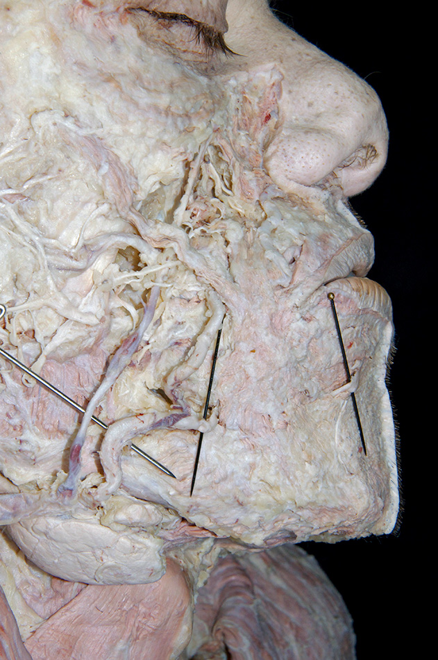 Inferior Labial Artery