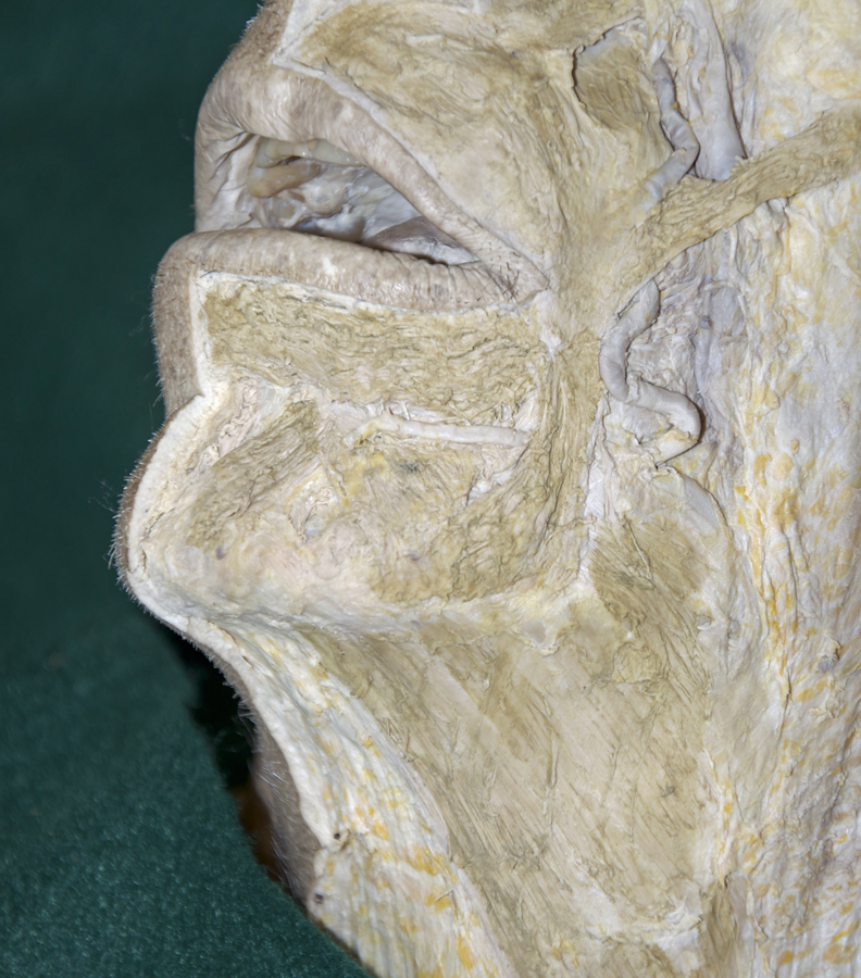 Lower Muscles of Facial Expression