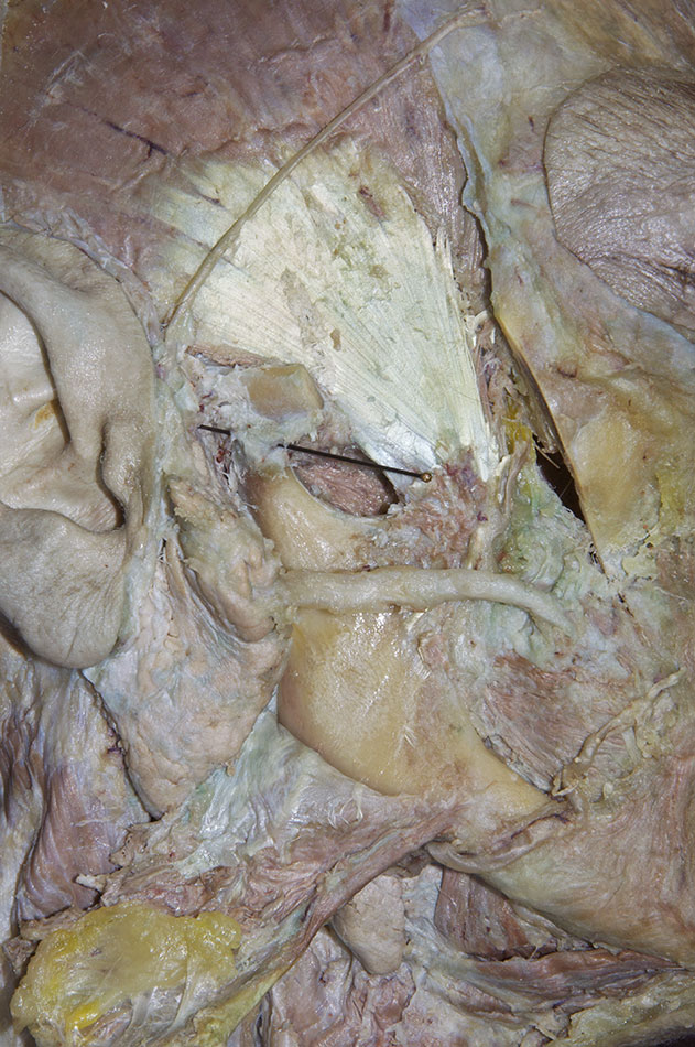 Joint Capsule