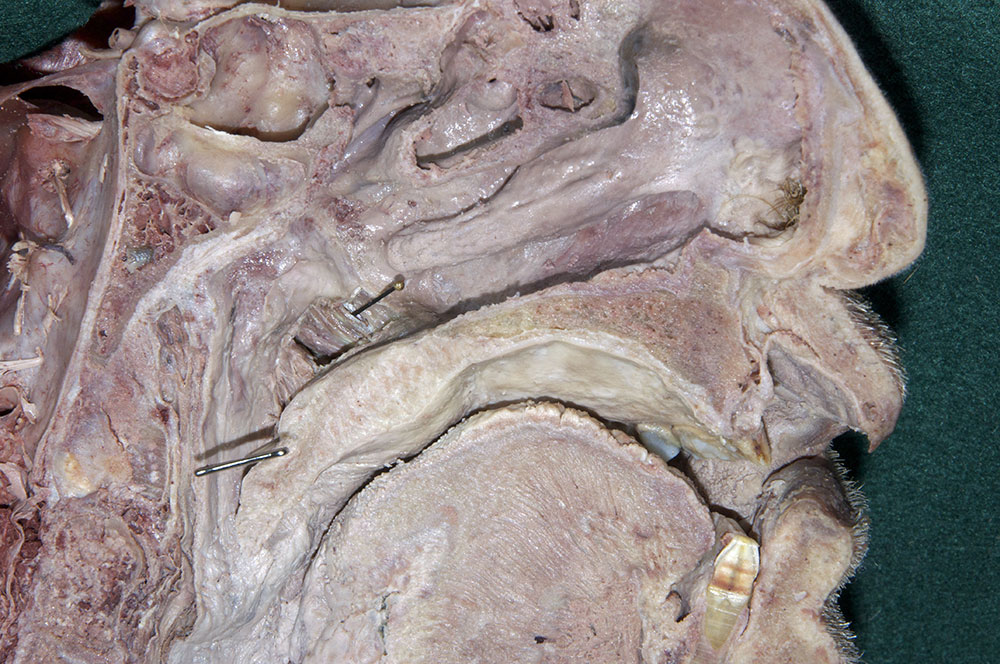 Palatine Muscles