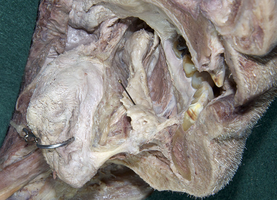 Sublingual Gland