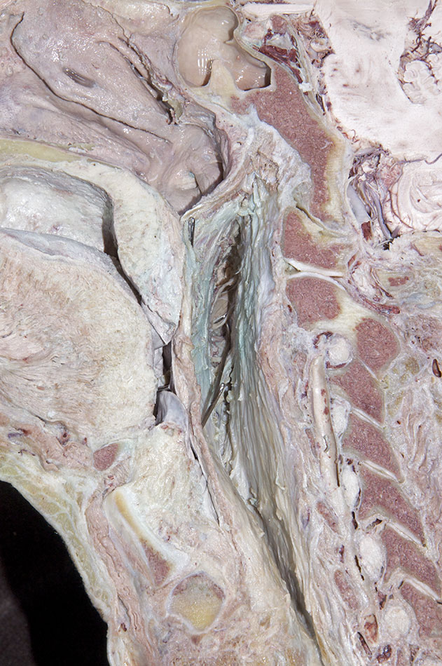 Stylopharyngeus Muscle