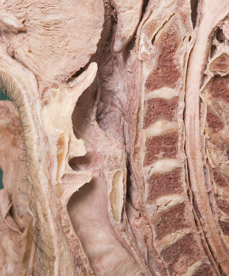 Larynx