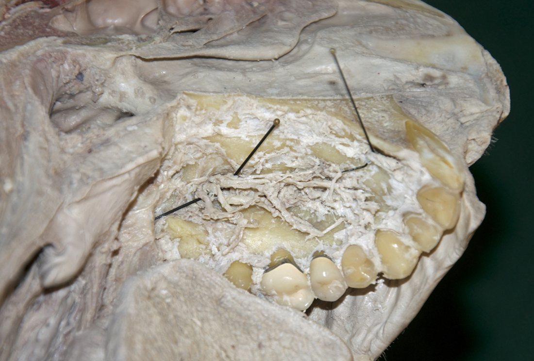 Hard Palate