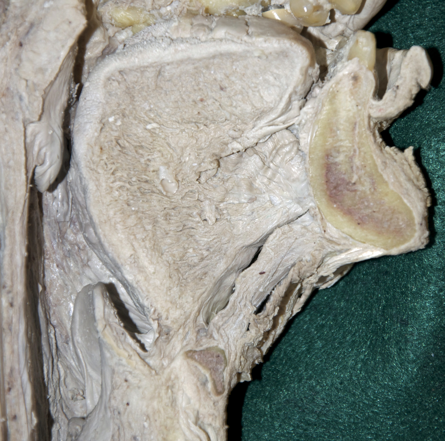 Left Tongue Muscles