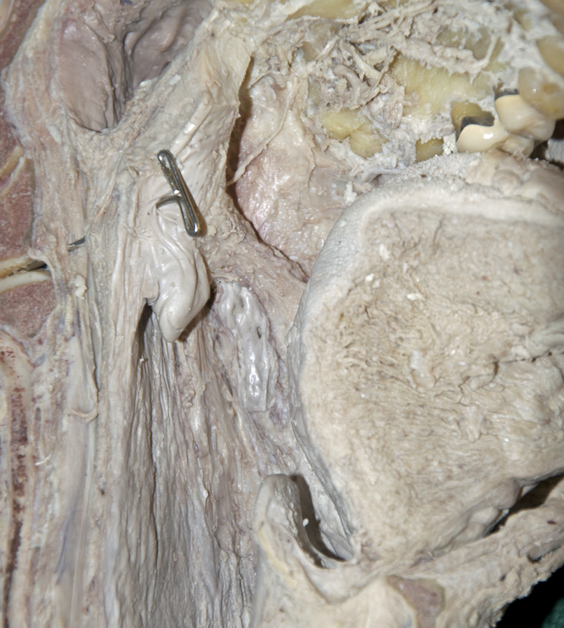 Palatoglossus Muscle