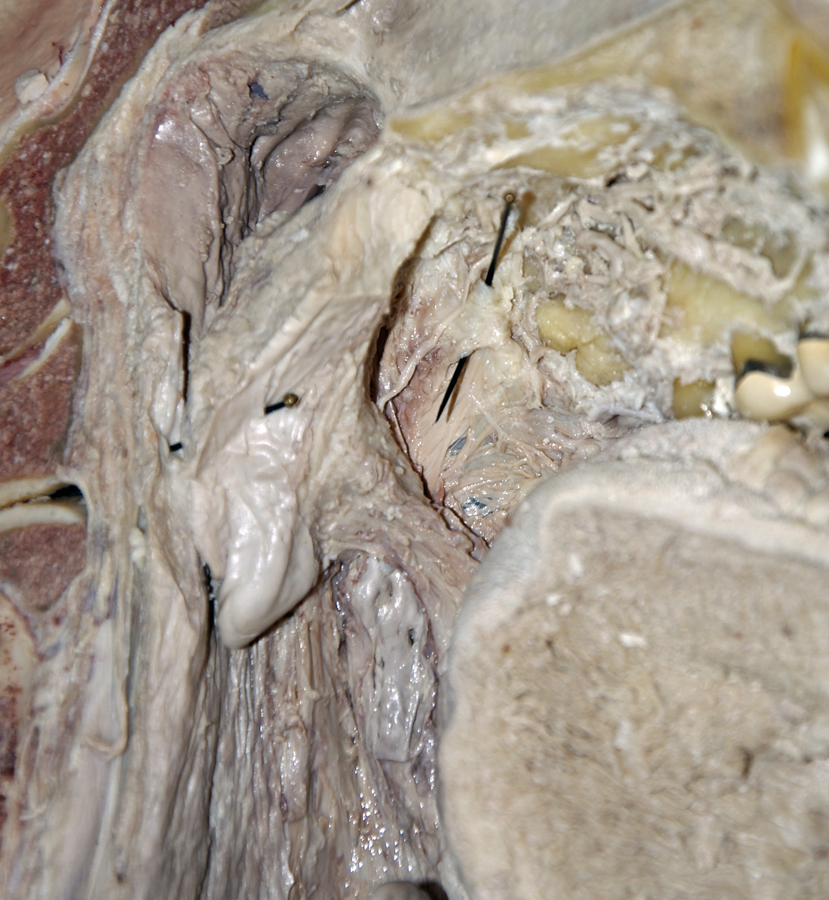 Tensor Palatini Aponeurosis