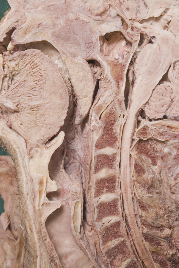 Pharynx