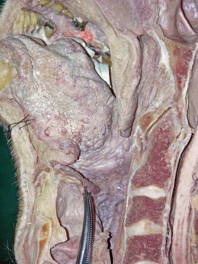 Right Oral Pharynx
