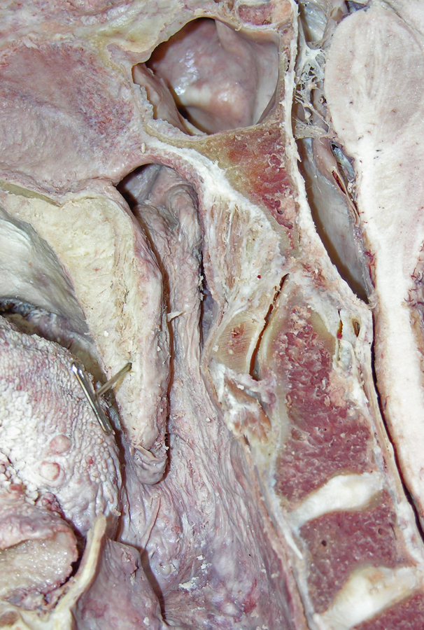Nasal Pharynx