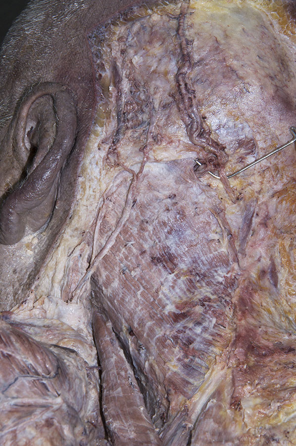Splenius Muscles