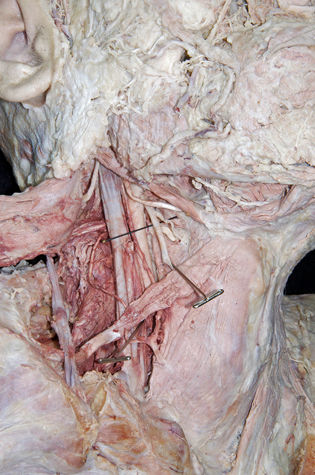 Internal Laryngeal Nerve