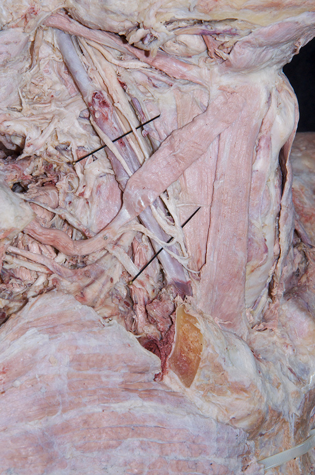 Ansa Cervicalis (muscular branches)