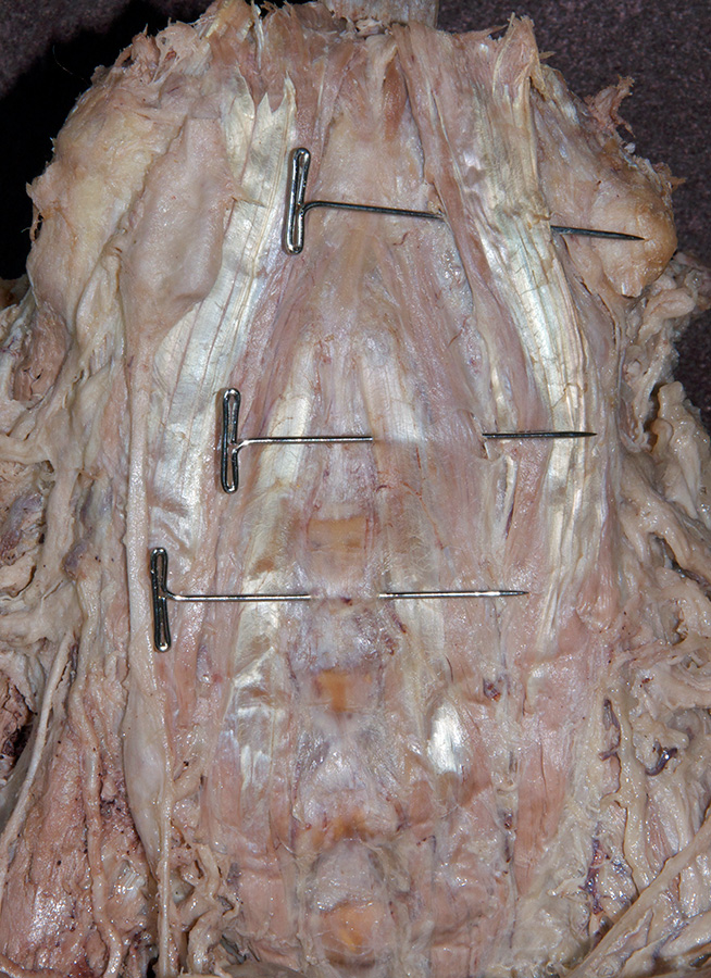 Longus Capitis and Colli Muscles