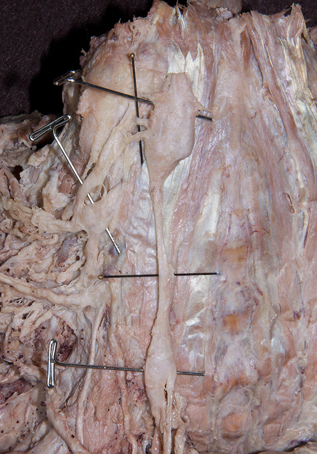 Superior Cervical Ganglion