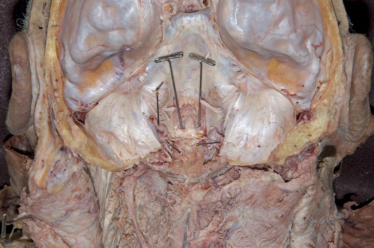 Cruciate Ligament
