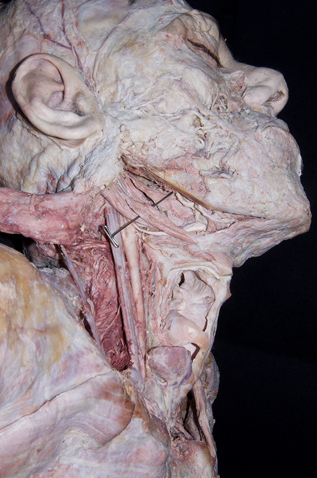 Stylohyoid Muscle