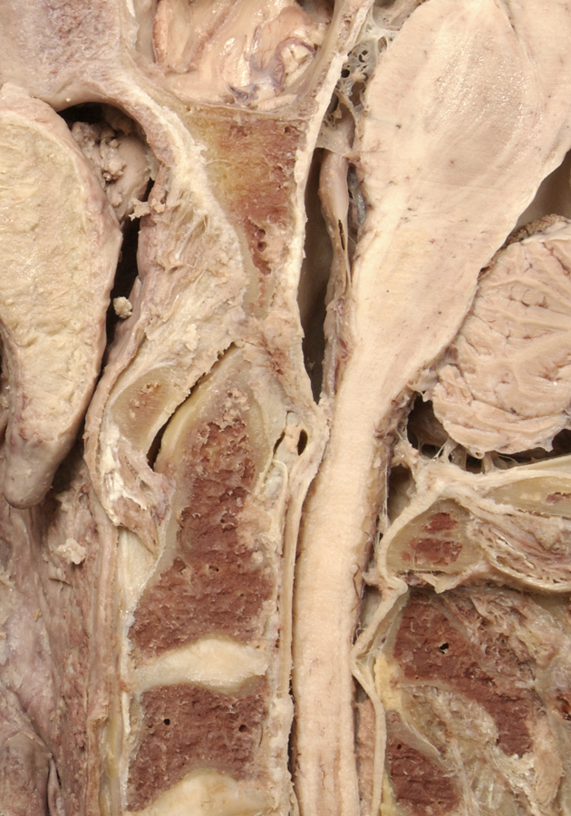 Transverse (Cruciate) Ligament