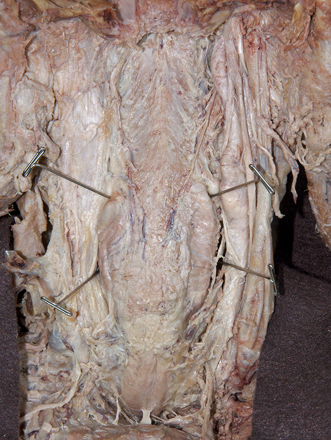 Pharyngeal Constrictors