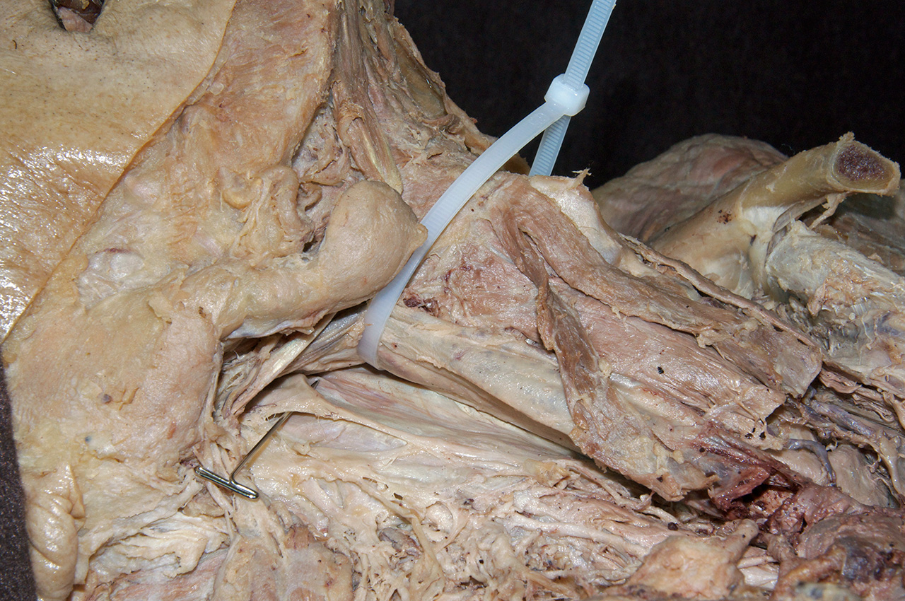 Visceral Neck Structures