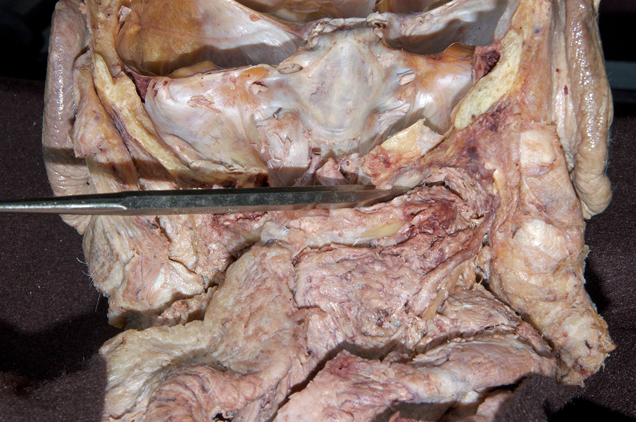 Atlanto-occipital Joint