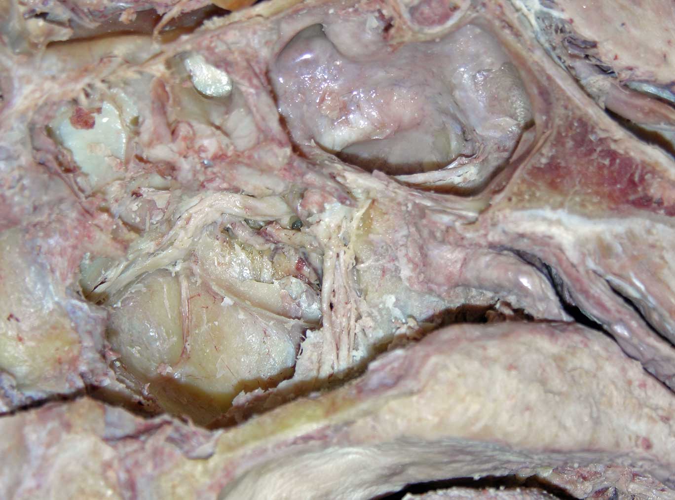 Nasal Cavity - 3