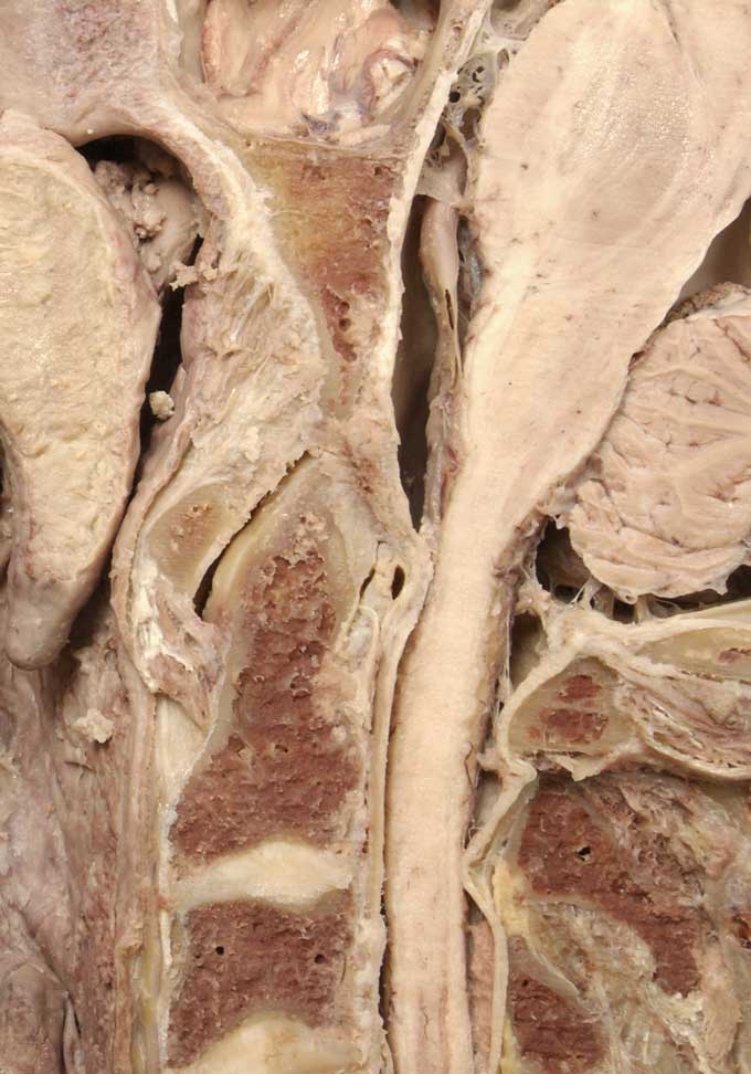 Prevertebral Region - 4