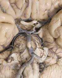 Brain - Cranial Nerves