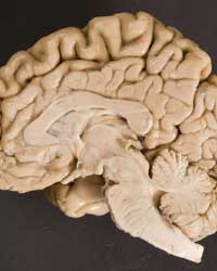 Brain - Median View