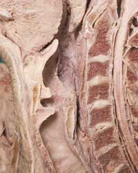 Larynx - Median View