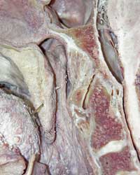 Nasal Pharynx