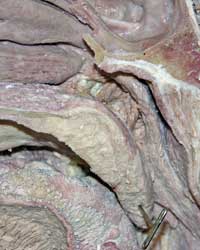 Palatal Muscles