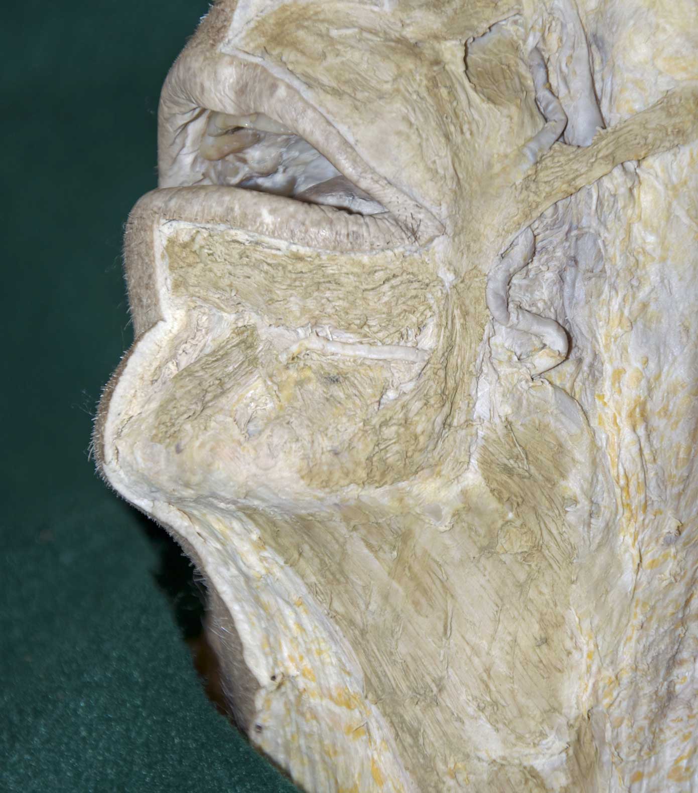 Face - 2