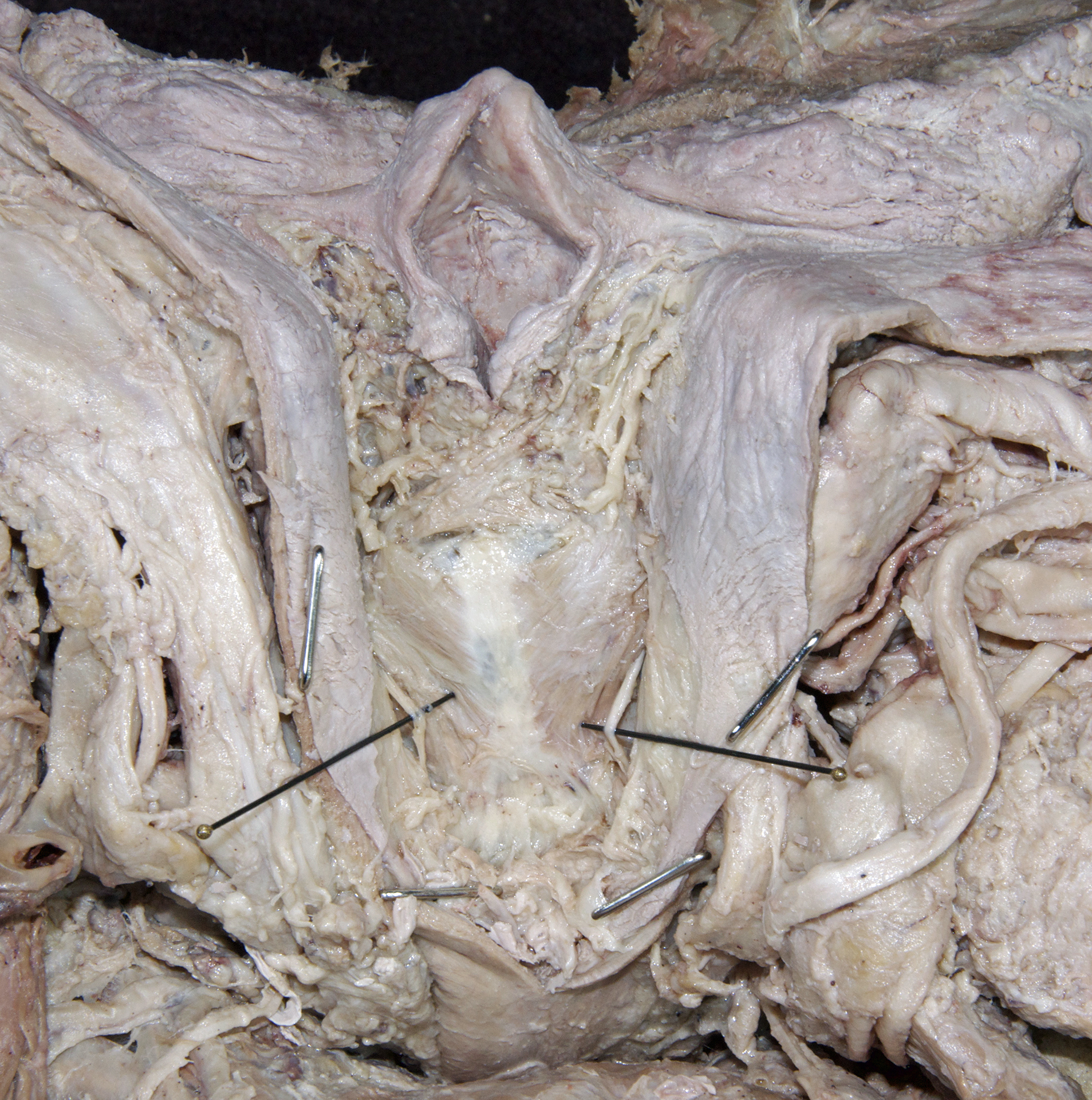 Larynx - 4
