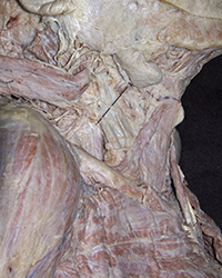 Deep Cervical Lymph Nodes