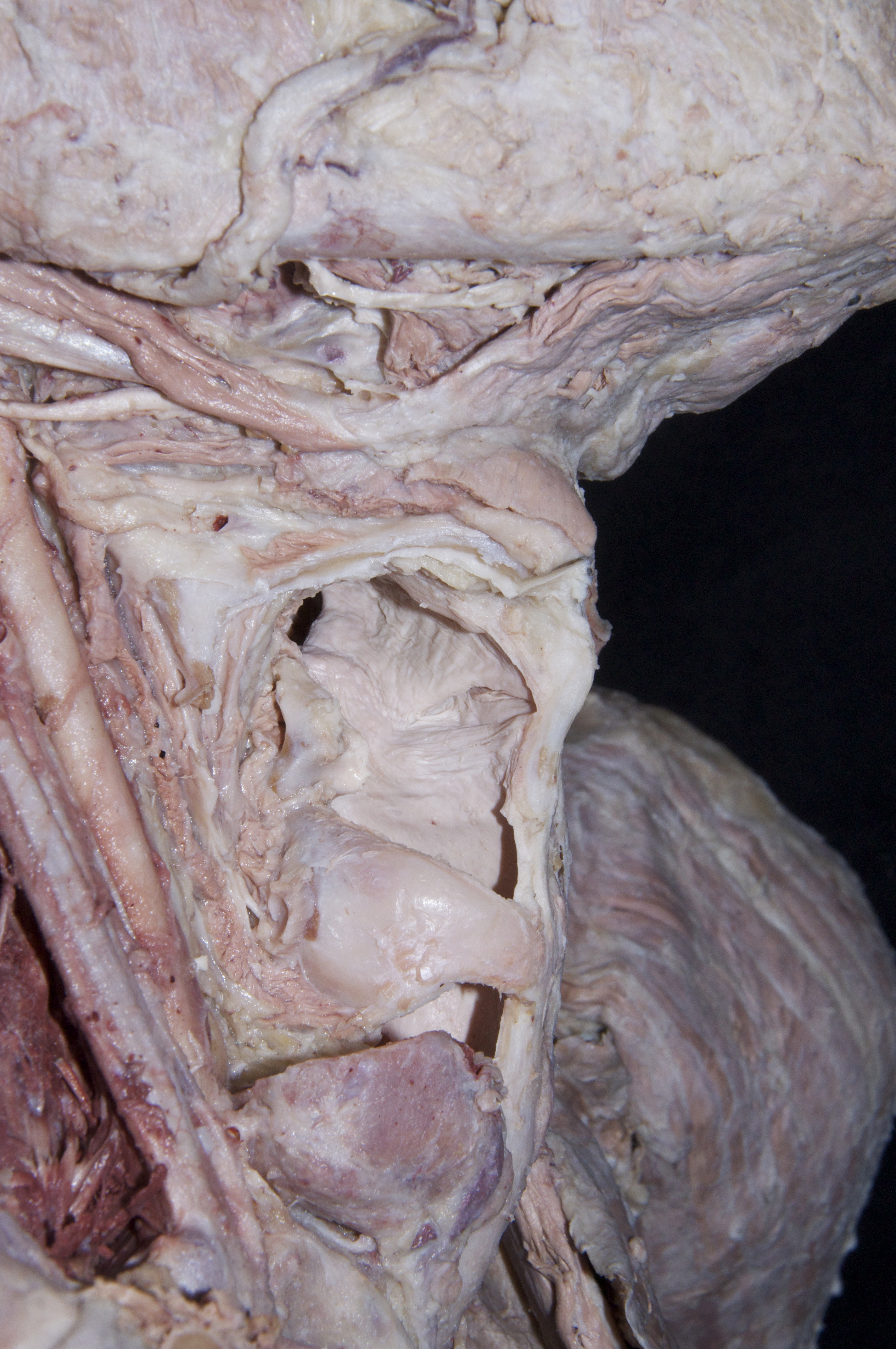 Larynx - 5