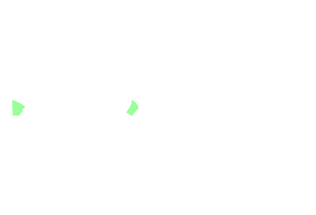 Infratrochlear nerve