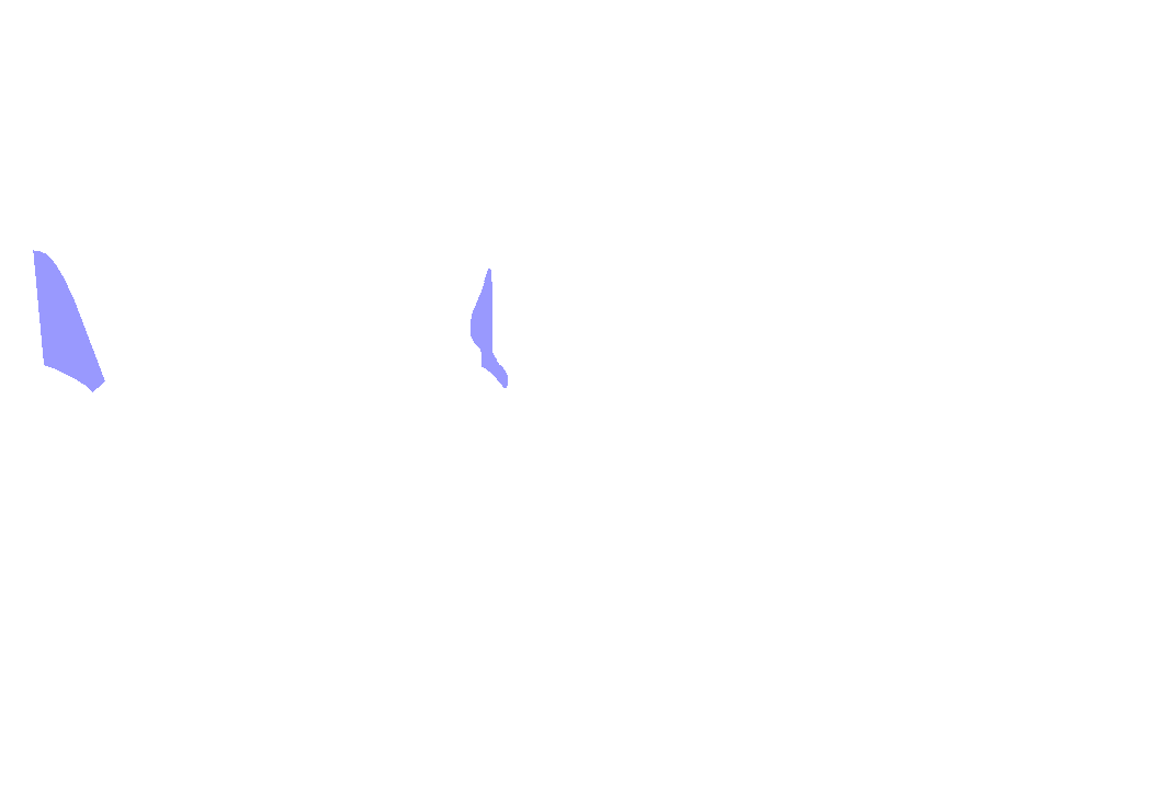 Supratrochlear nerve