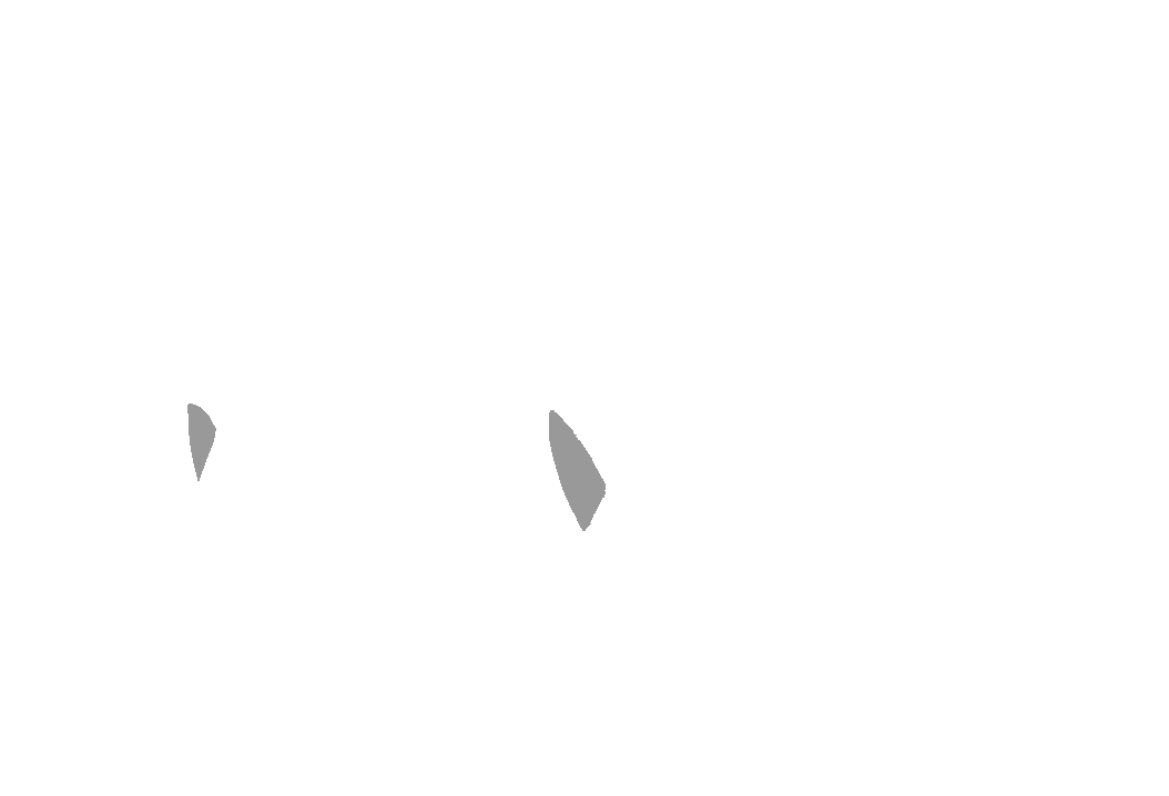 Zygomaticofacial nerve