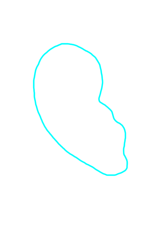 Auricle (pinna)