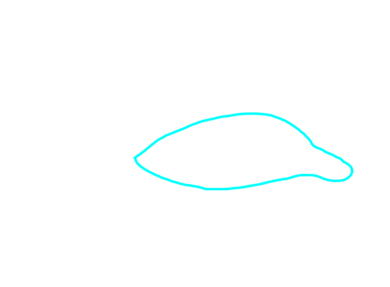 Palpebral fissure