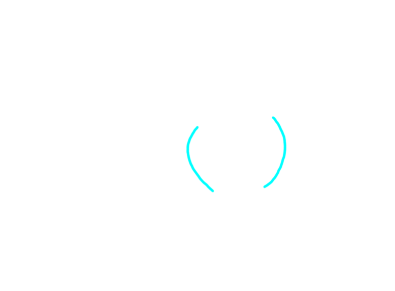 sclerocorneal junction (limbus)