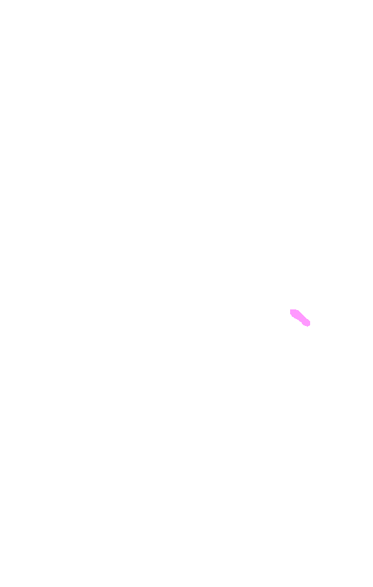 Adductor Tubercle